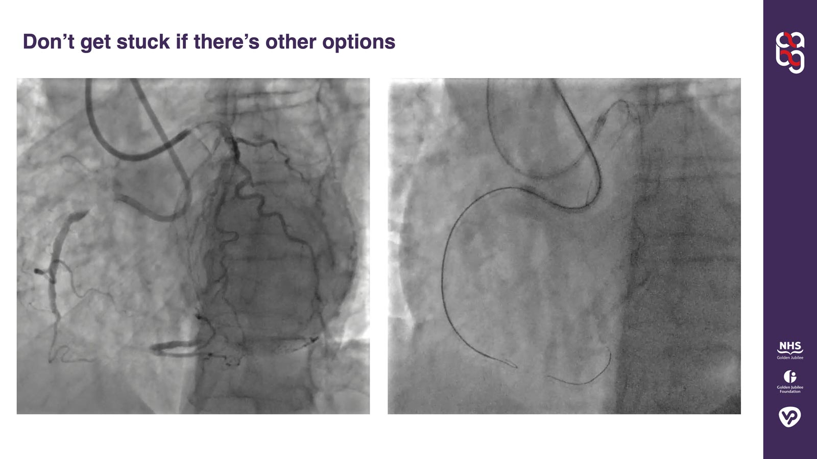 Case angios nasty disease