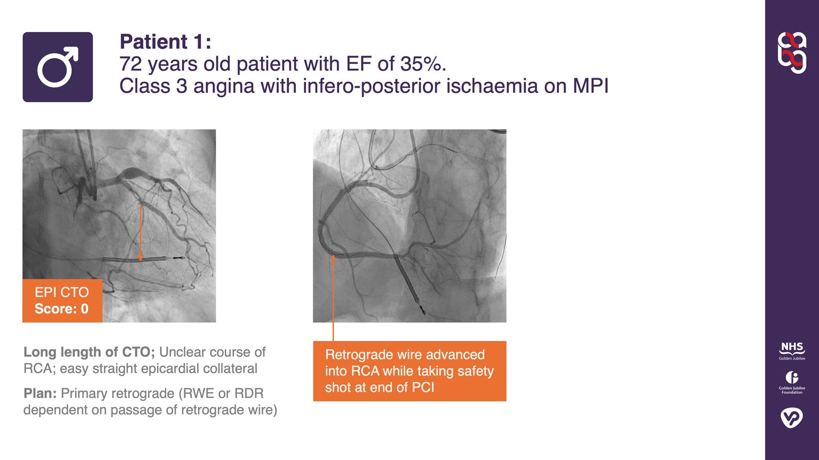 More detailed case example