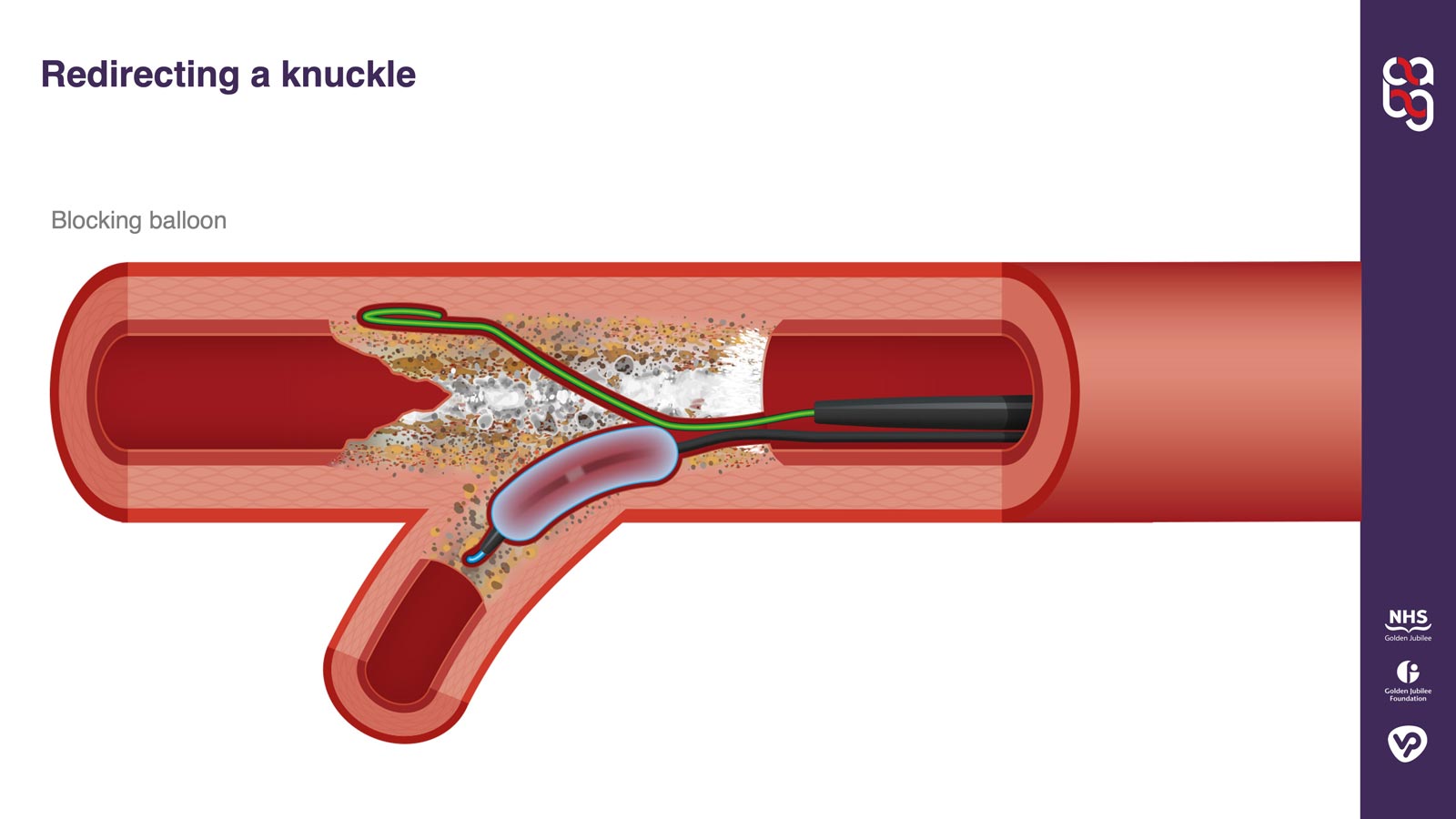 Technique illustration example