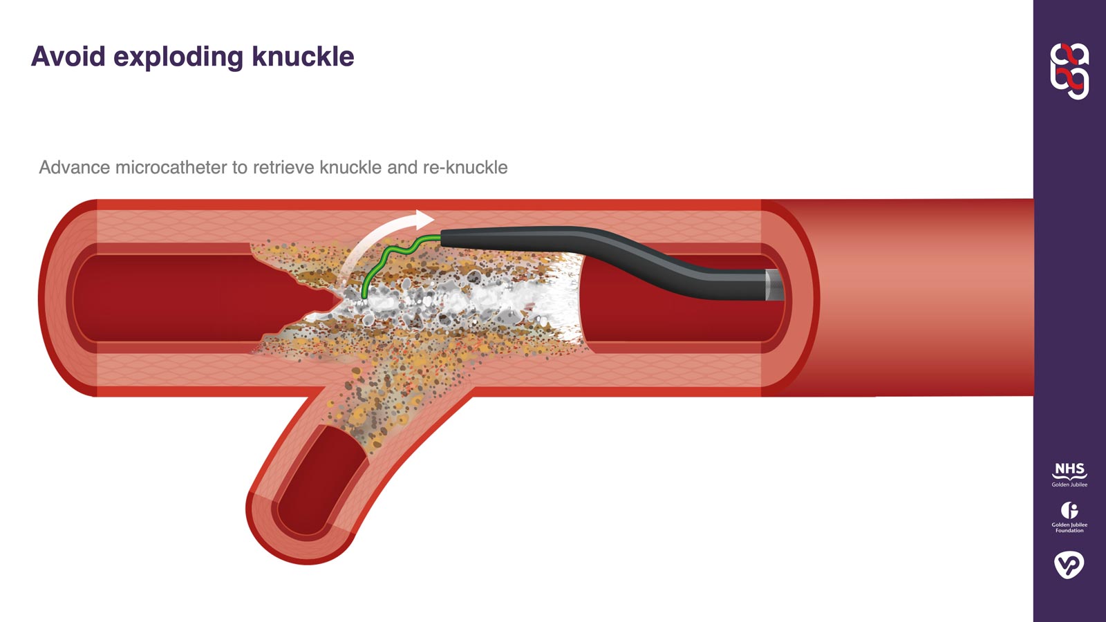 Technique illustration example